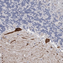 NBP1-86654 - Carbonic anhydrase 8